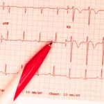 Entendiendo la Onda de Pulso Arterial: Un Latido que Habla de Tu Salud